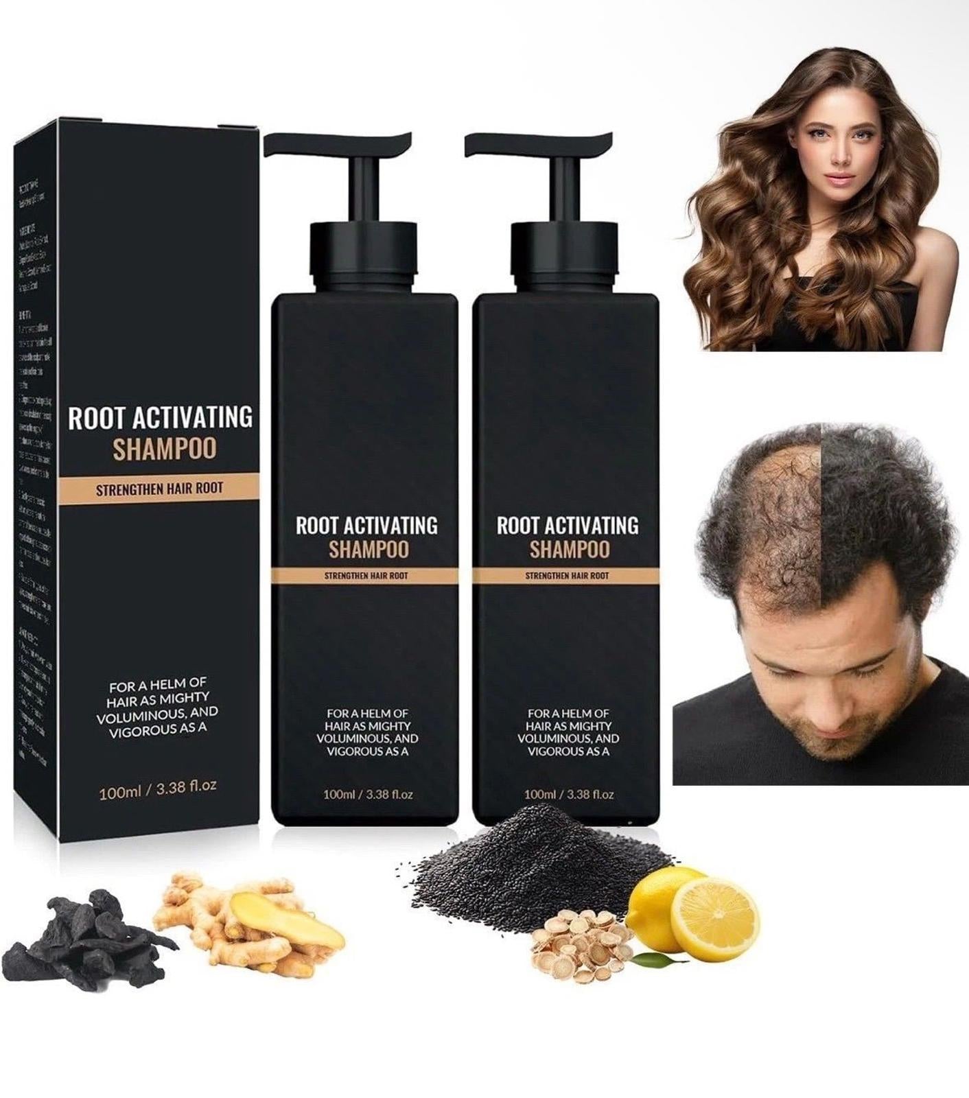 1/2x Root Activator Shampoo, SPARTAN Hair Loss Shampoo Shampoo Root Activator